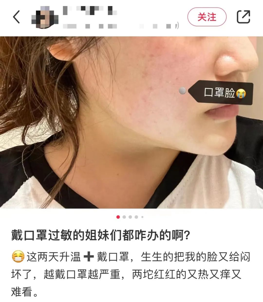 戴了三年的口罩，你還摘得下來(lái)嗎？