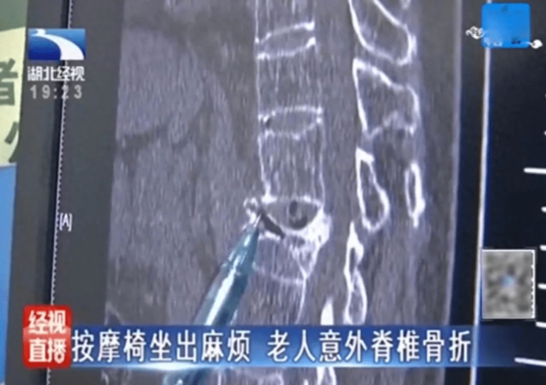 生蟲、卡頭發(fā)、致骨折——共享按摩椅你還敢坐嗎？